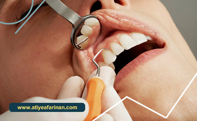 تحصیل دندانپزشکی استونی